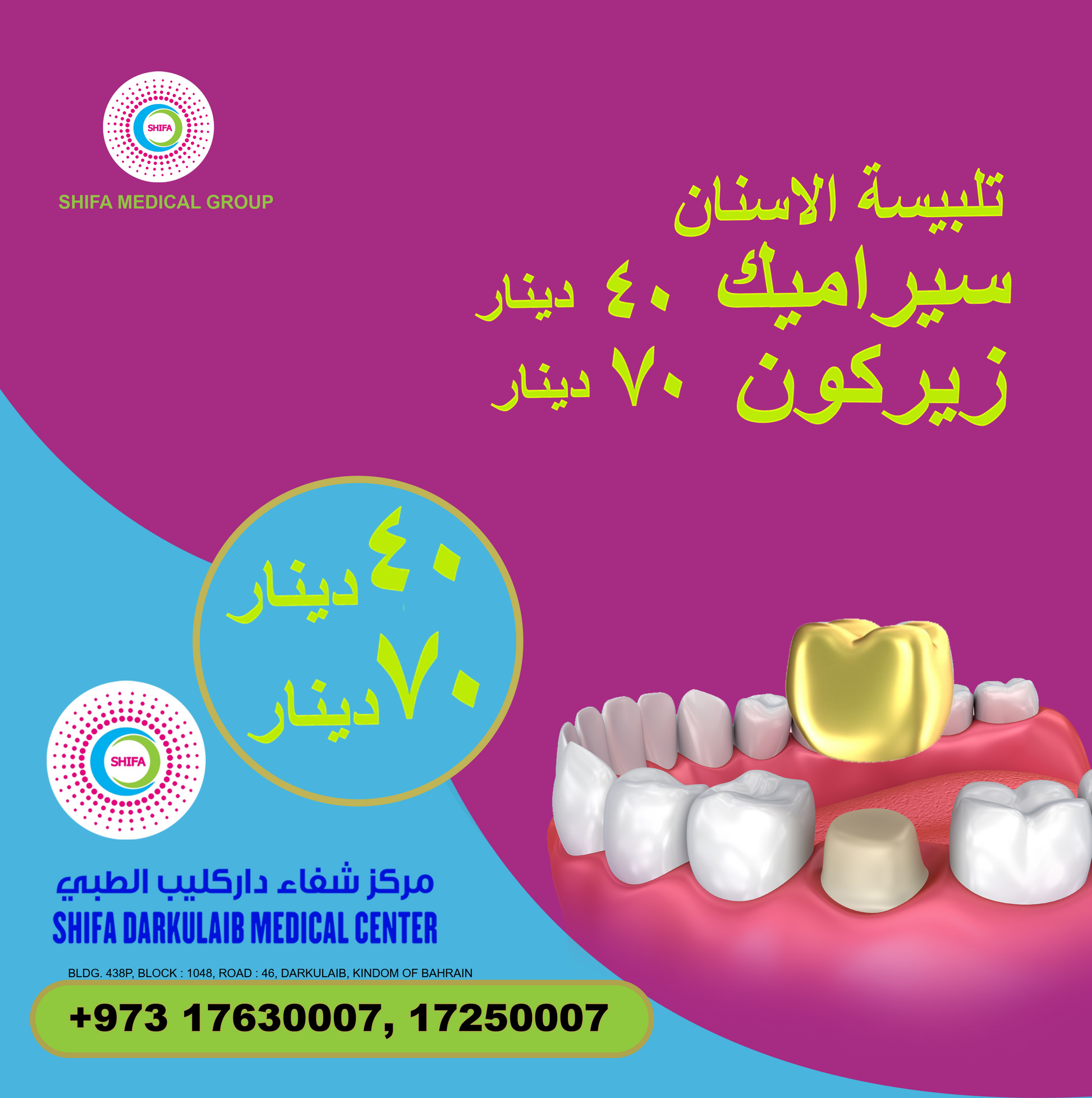 Dental Crowns β Ceramic & Zircon