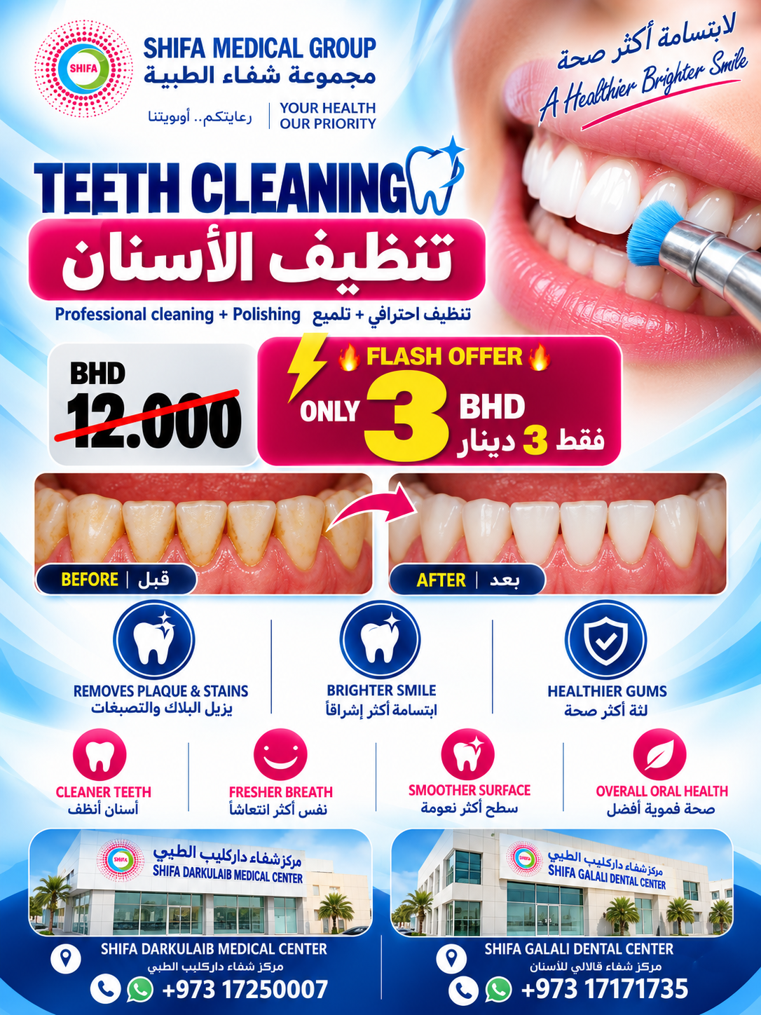 Scaling & Polishing offer at Shifa