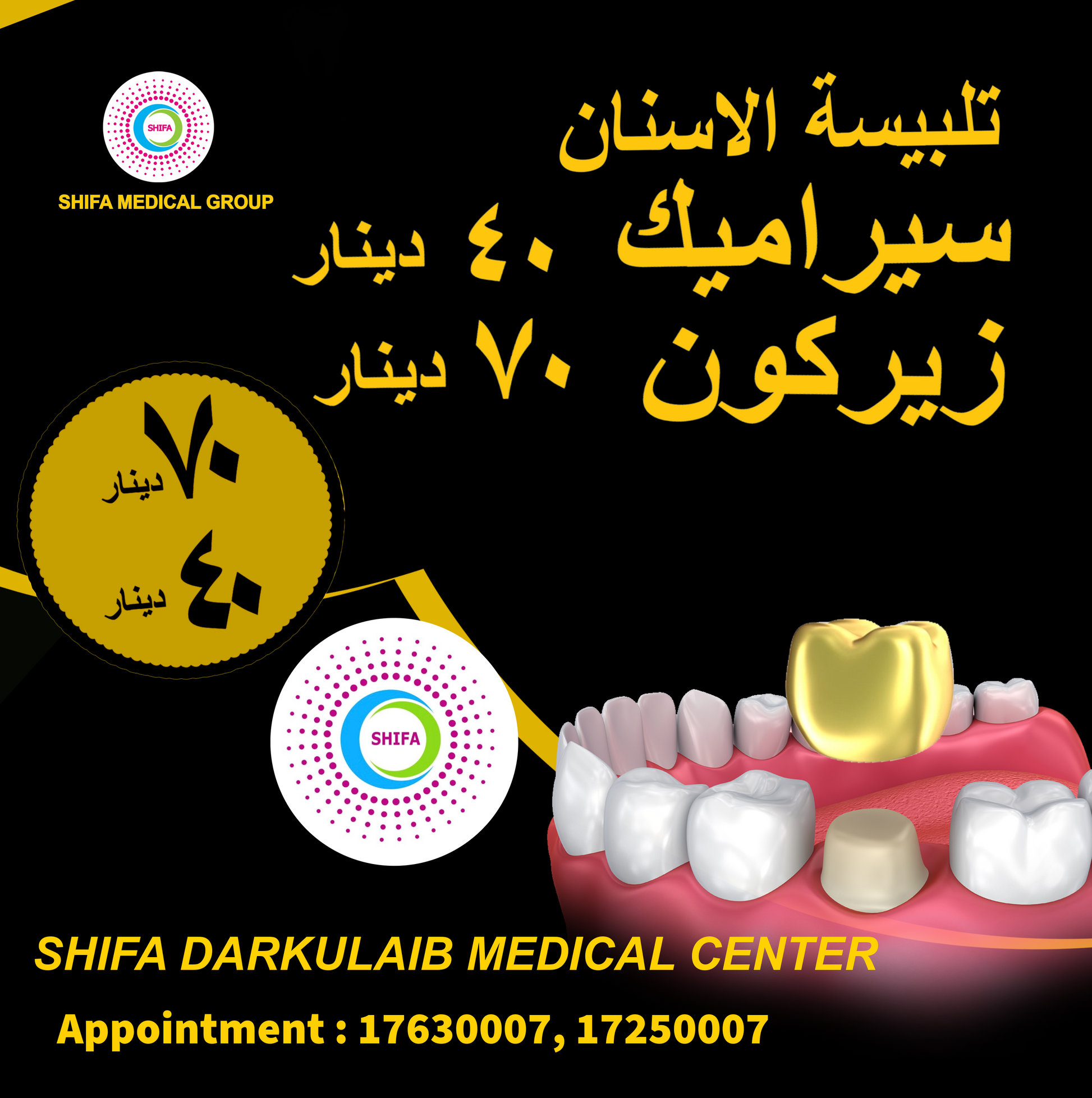 Dental Crowns – Ceramic & Zircon