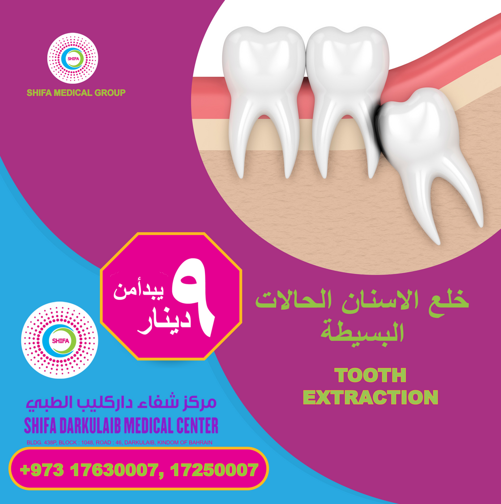 Simple Tooth Extraction