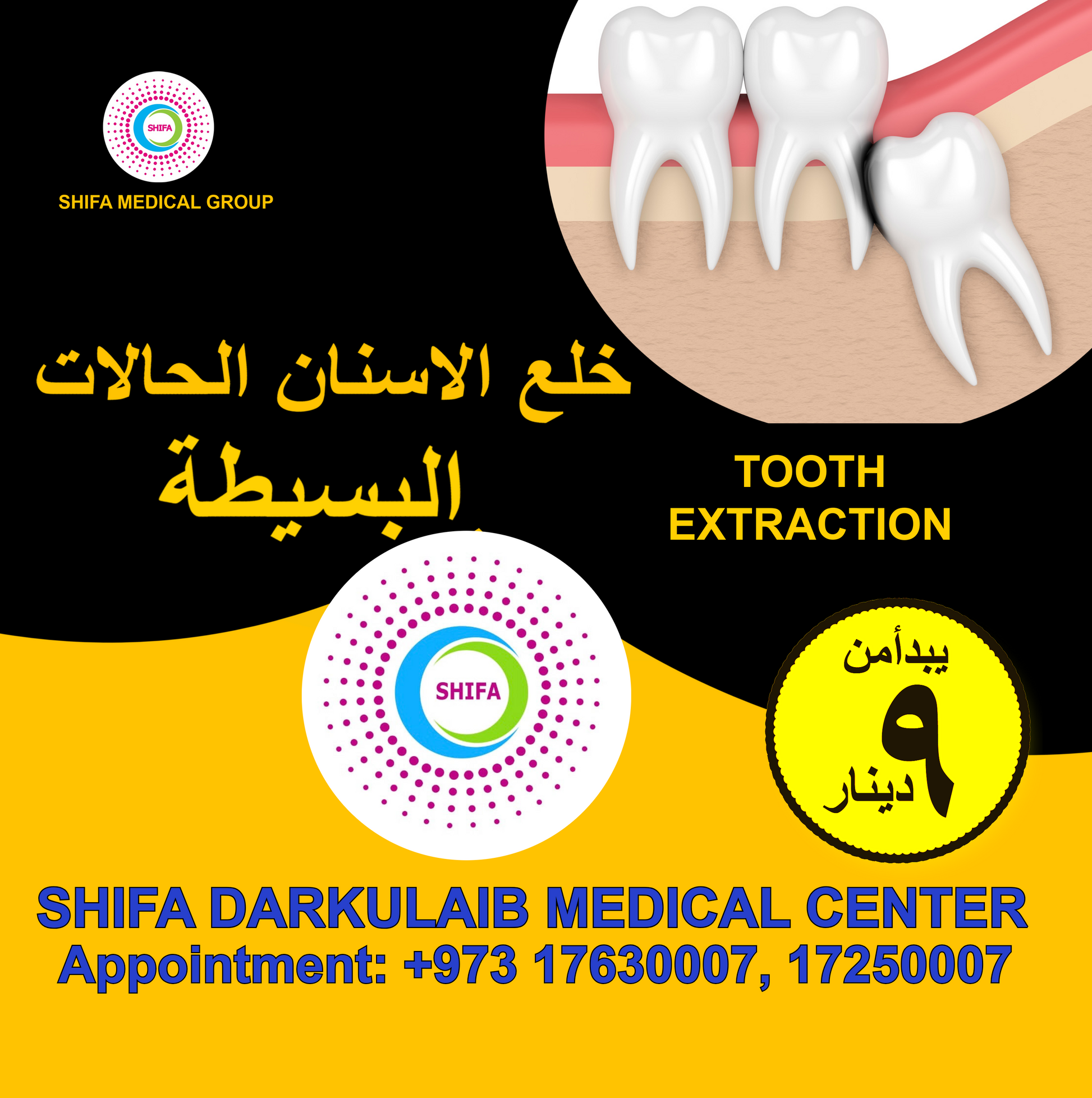 Simple Tooth Extraction