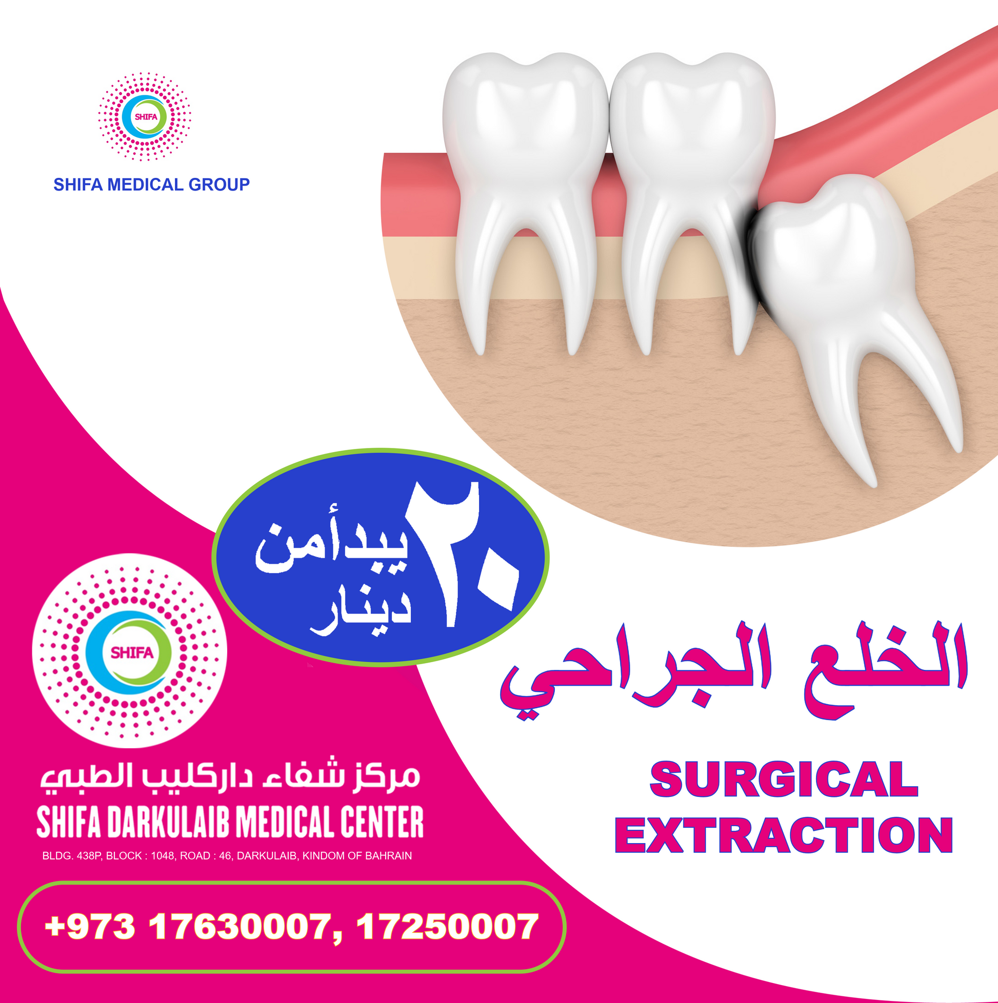 Surgical Tooth Extraction